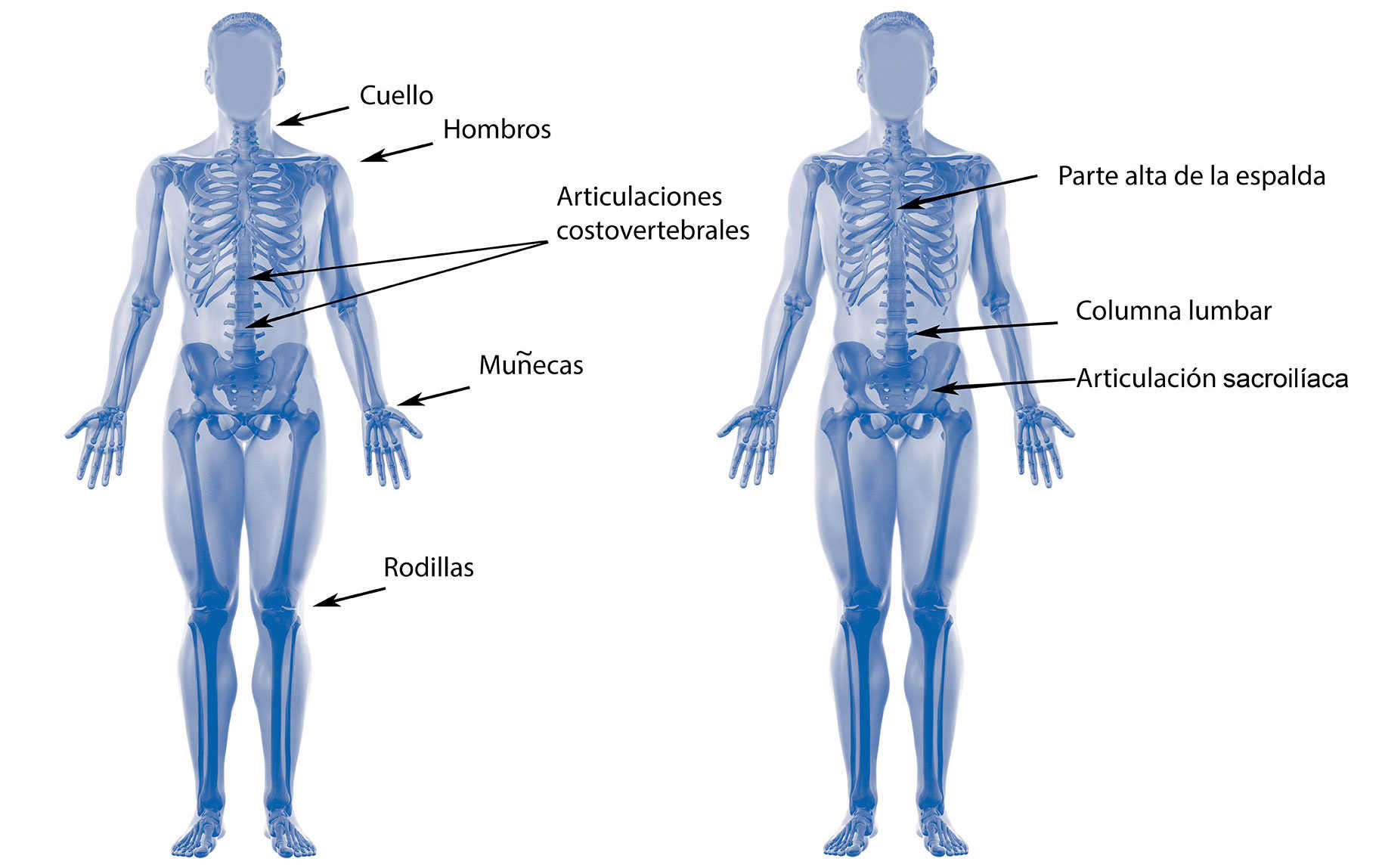 Espondilitis anquilosante: 11 signos de alerta por dolor en la espalda